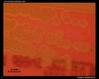 viridans streptococci